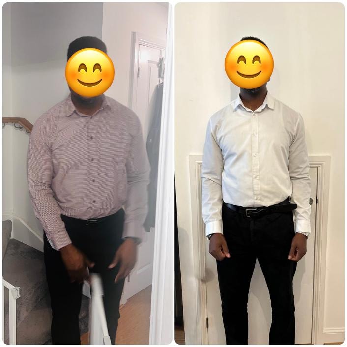 Before-and-after photograph from an approved patient journey