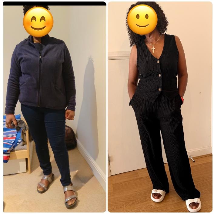 Before-and-after photograph from an approved patient journey