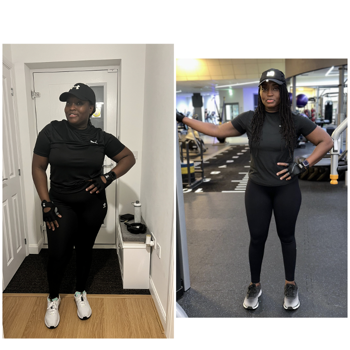 Before-and-after photograph from an approved patient journey